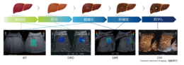 キヤノンメディカルシステムズ／超音波診断装置「Aplio iシリーズ」のアプリケーション「Liver Package」による非侵襲的な肝臓の脂肪化、炎症、線維化の評価法を検証（24.11.14）