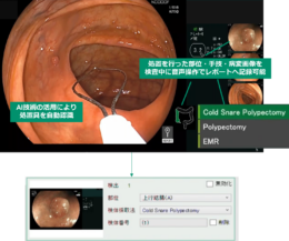 富士フイルム／音声操作による入力機能を新たに搭載 下部内視鏡レポート作成支援ソフトウェア「AR-C1 Ver2.0」提供開始（24.12.9）